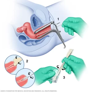 Pap Smear